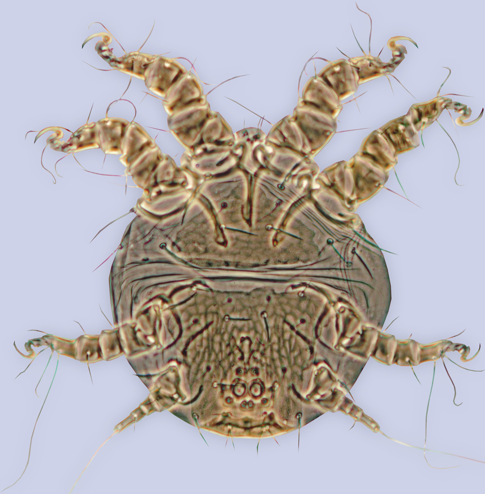 Chaetodactylus abditus, phoretic deutonymph (holotype), ex Lithurgus planifrons, Arizona, BMOC 96-0510-012