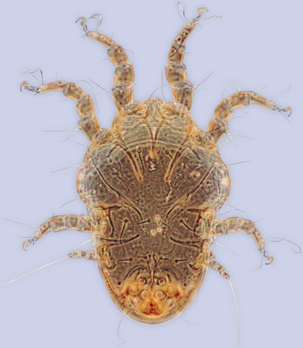 Sennertia sodalis, phoretic deutonymph (holotype), ex Ceratina sp., Mexico, BMOC 03-1008-055
